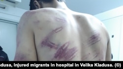 Një migrant i lënduar në një spital në Vellika Klladusha.