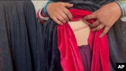 Jedna majka je izjavila da je razmišljala o prodaji svog djeteta usred humanitarne i ekonomske krize koja je zahvatila Afganistan, dodajući da je već prodala svoj bubreg. Mnogi drugi tvrde da su učinili isto.