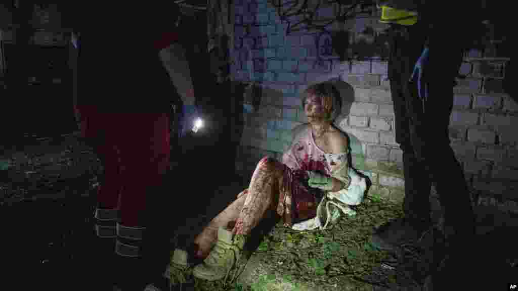 Ранета жена седи покрај нејзината куќа во Киев, по рускиот напад