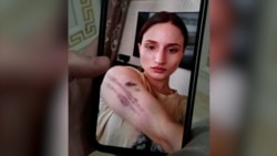 Айшат Баймурадова