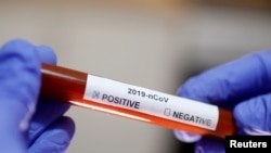 Test za korona virus