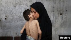 Samah Matar, o mamă palestiniană strămutată, își ține în brațe fiul subnutrit, Youssef, care suferă de paralizie cerebrală, într-o școală unde se adăpostesc în timpul crizei alimentare, în orașul Gaza, 24 iulie 2025.
