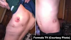 პოლიცია ადასტურებს, რომ არასრულწლოვანს ძალადობის შედეგად სხეულის სხვადასხვა არეში „მრავლობითი დაზიანება აღენიშნება“.