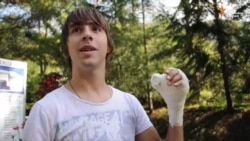 Foča: Prva replantacija šake u bolnici