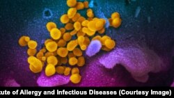 SARS-COV-2 (în galben) pe un țesut uman, imagine la microscop